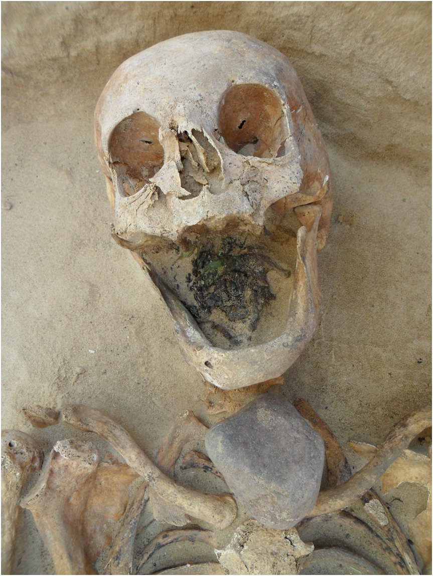 Figura 2. Individuo 60-2010 (mujer de 45-49 años) con una piedra colocada directamente en la parte superior de la garganta. Lesley Gregoricka.png